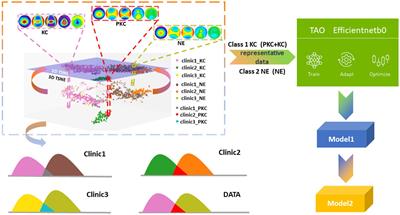 The development of a machine learning model to train junior ophthalmologists in diagnosing the pre-clinical keratoconus